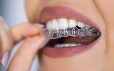 Invisalign: A Clear Path to Straighter Teeth  